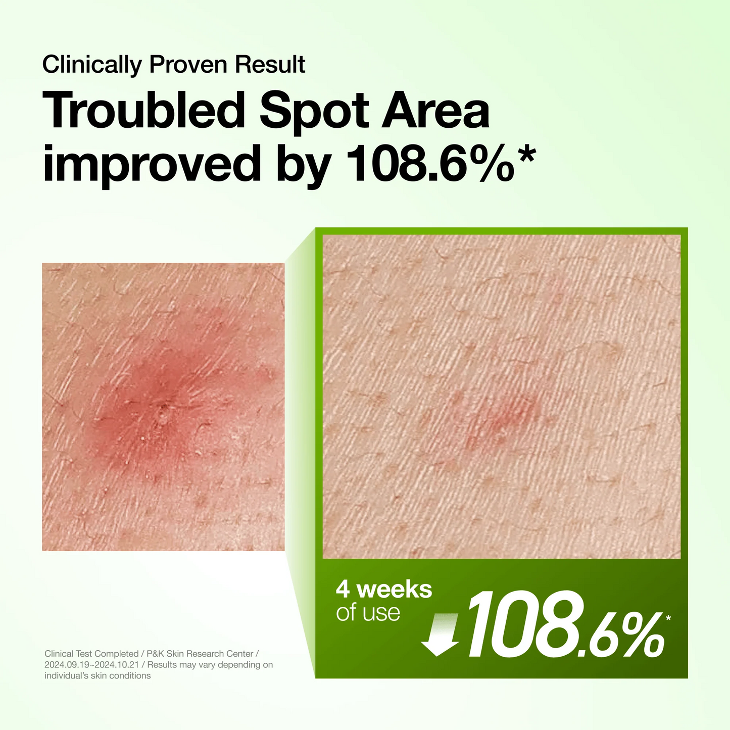 Azelaic 10 Redness Soothing Serum
