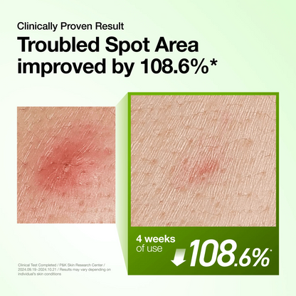 Azelaic 10 Redness Soothing Serum