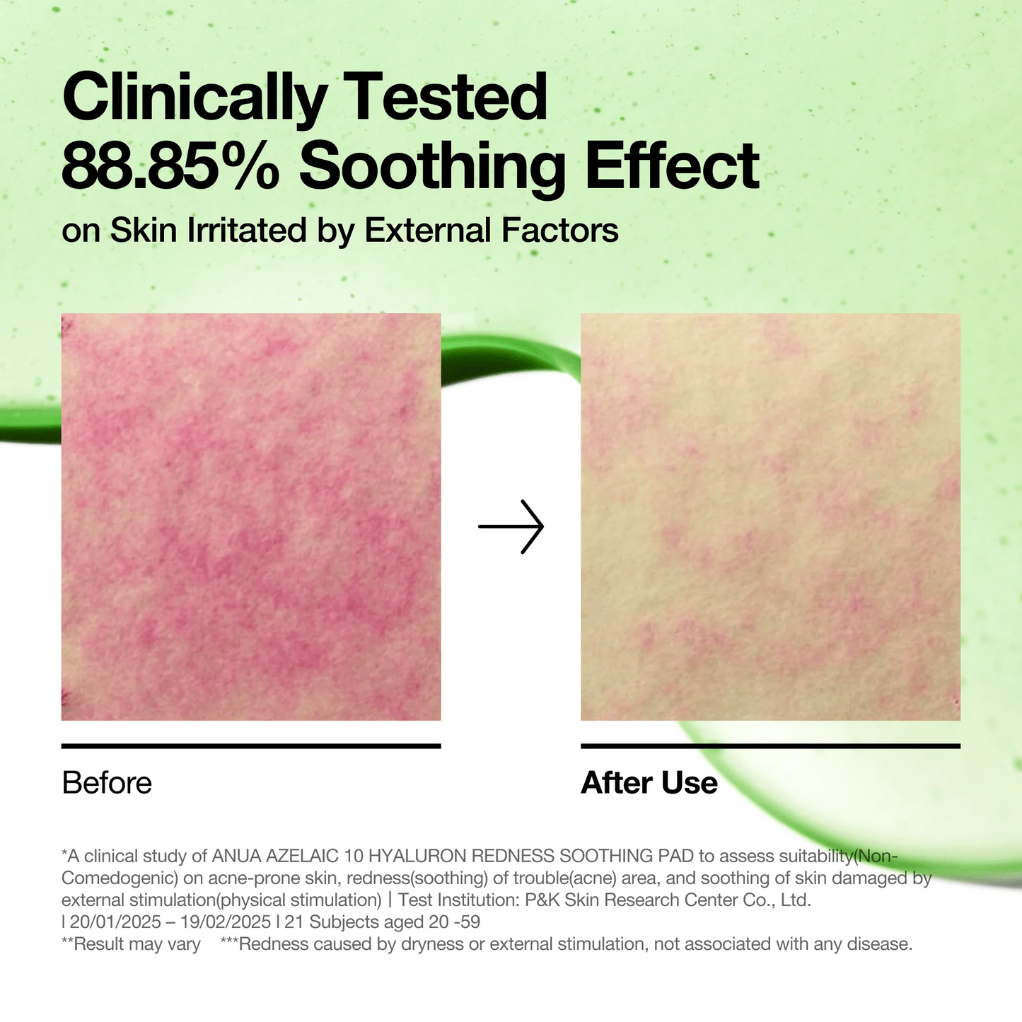 Azelaic 10 Redness Soothing Serum